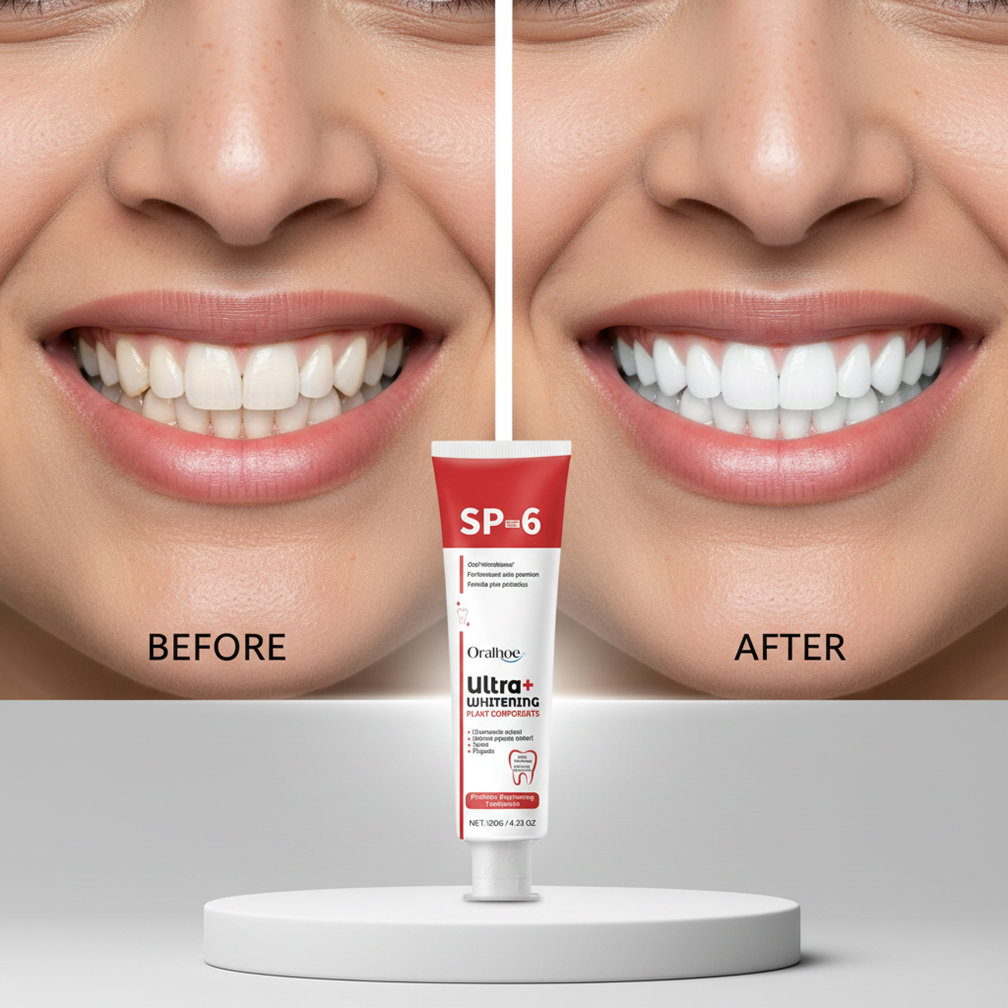 SP6 - المعجون اصلا و الأقوى لتبييض الأسنان