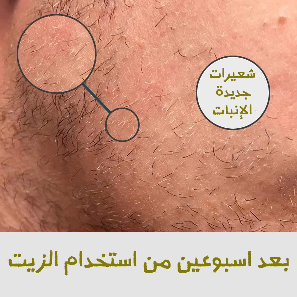 زيت نمو شعر اللحية